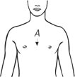 Bort Rippengürtel, elastisch für Herren, weiß Gr. XXL